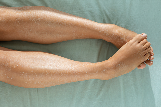 Dry Skin on Legs: The Cause(s) & Solution(s) 