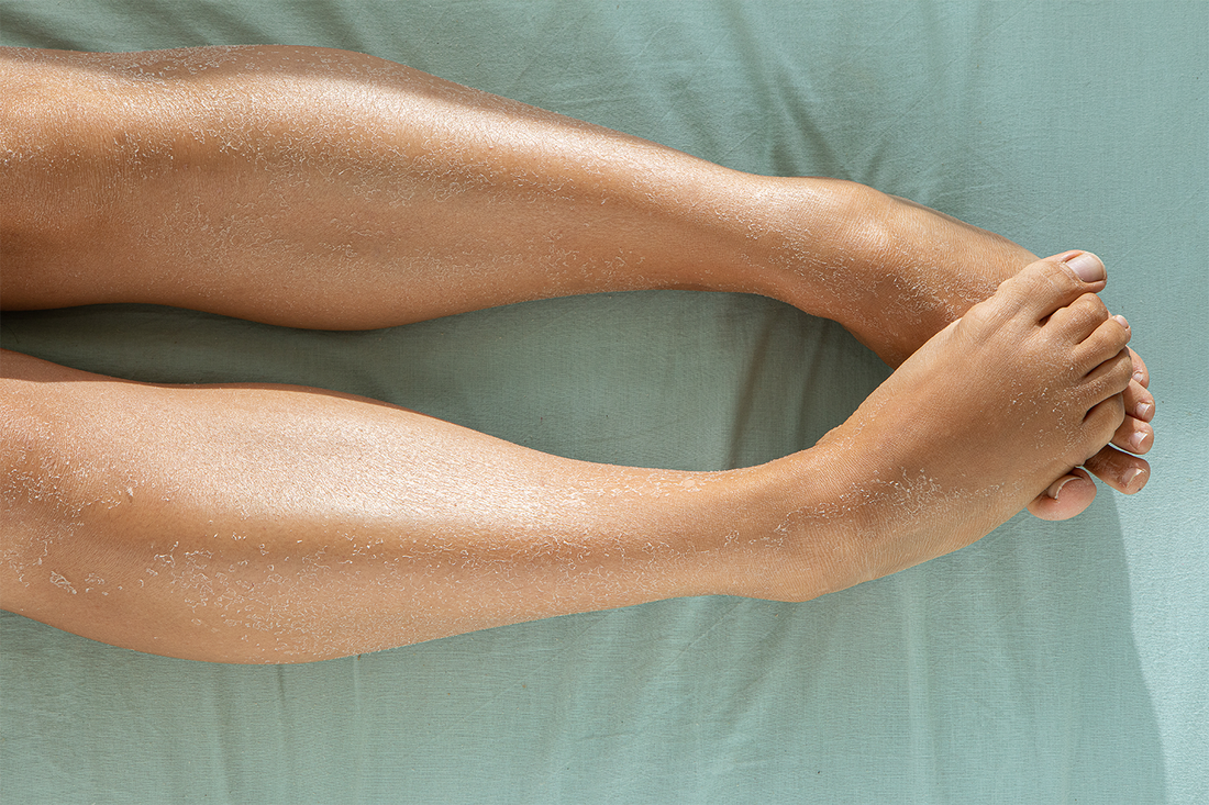 Dry Skin on Legs The Causes & Solutions Spongellé
