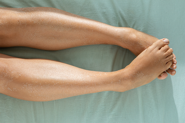Chapped Legs Dry Skin on Legs: The Causes & Solutions | Spongellé
